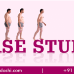 Gynecomastia Surgery in mumbai, india